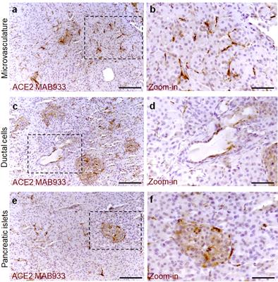 SARS-CoV-2 Receptor Angiotensin I-Converting Enzyme Type 2 (ACE2) Is Expressed in Human Pancreatic β-Cells and in the Human Pancreas Microvasculature